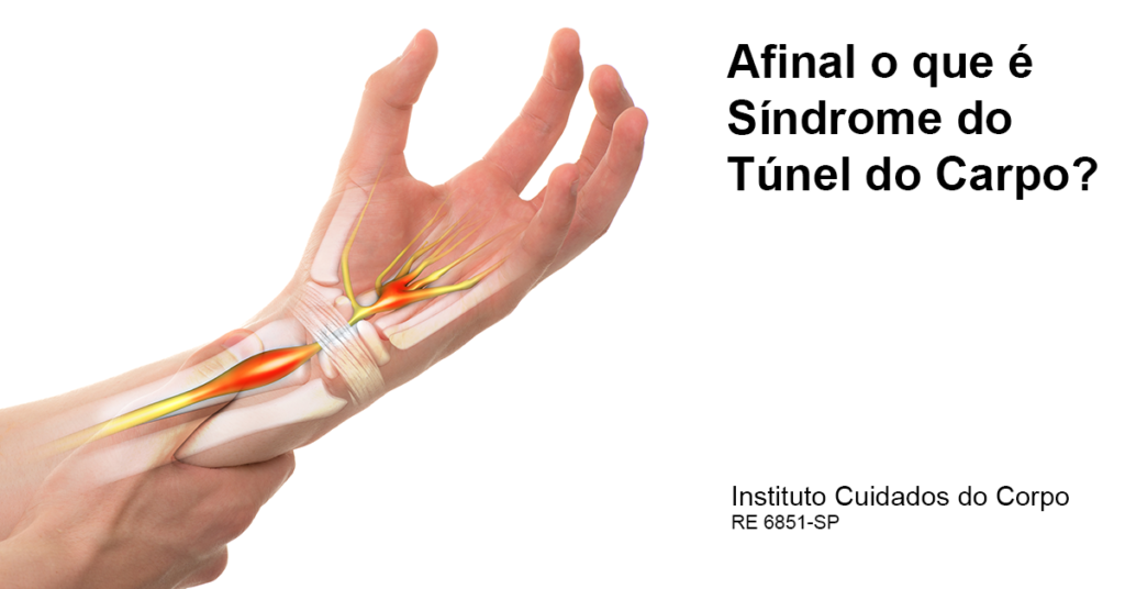 Síndrome do túnel do carpo. – Instituto Cuidados do Corpo